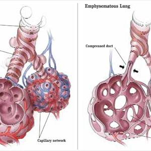 Remedy For Bronchitis Cough - Soothe Our Bodies With Marshmallow Root Herb