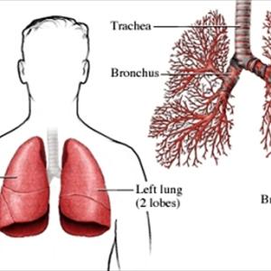 Bronchial Infections - Causes - Bacterial May Well Be The Reason For Bronchitis